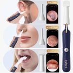 گوش پاک کن هوشمند بیبرد مدل EarSight Plus - تصویر 4